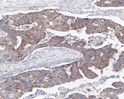 Invitrogen C1QBP Recombinant Rabbit Monoclonal Antibody (JE60-96) 100 &mu;L;