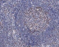 Invitrogen C1QBP Recombinant Rabbit Monoclonal Antibody (JE60-96) 100 &mu;L;