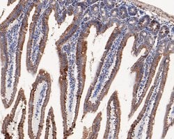 Invitrogen C1QBP Recombinant Rabbit Monoclonal Antibody (JE60-96) 100 &mu;L;