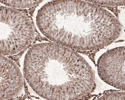 Invitrogen C1QBP Recombinant Rabbit Monoclonal Antibody (JE60-96) 100 &mu;L;
