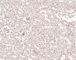 Invitrogen PIAS1 Recombinant Rabbit Monoclonal Antibody (JE36-84) 100 &mu;L;