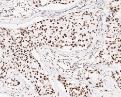 Invitrogen USP39 Recombinant Rabbit Monoclonal Antibody (JE61-02) 100 &mu;L;