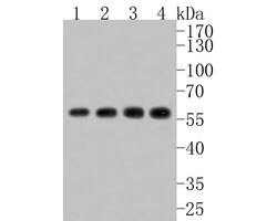 Invitrogen CAP1 Recombinant Rabbit Monoclonal Antibody (JE61-08) 100 &mu;L;
