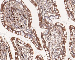 Invitrogen NDRG3 Recombinant Rabbit Monoclonal Antibody (JE61-18) 100 &mu;L;