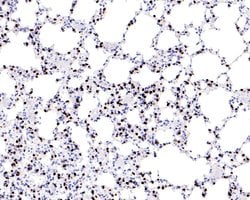 Invitrogen Nkx2.1 Recombinant Rabbit Monoclonal Antibody (JE61-73) 100 &mu;L | Buy Online | Invitrogen&trade; | Fisher Scientific