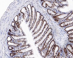 Invitrogen SR Recombinant Rabbit Monoclonal Antibody (JE61-82) 100 &mu;L;