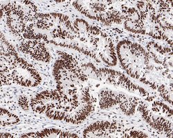 Invitrogen SR Recombinant Rabbit Monoclonal Antibody (JE61-82) 100 &mu;L;