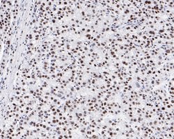 Invitrogen SR Recombinant Rabbit Monoclonal Antibody (JE61-82) 100 &mu;L;
