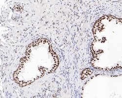 Invitrogen SR Recombinant Rabbit Monoclonal Antibody (JE61-82) 100 &mu;L;