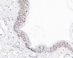 Invitrogen SR Recombinant Rabbit Monoclonal Antibody (JE61-82) 100 &mu;L;