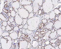 Invitrogen SR Recombinant Rabbit Monoclonal Antibody (JE61-82) 100 &mu;L;