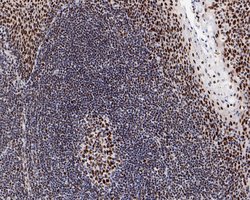 Invitrogen SR Recombinant Rabbit Monoclonal Antibody (JE61-82) 100 &mu;L;