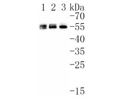 Invitrogen SR Recombinant Rabbit Monoclonal Antibody (JE61-82) 100 &mu;L;