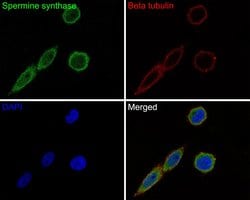 Invitrogen SMS Recombinant Rabbit Monoclonal Antibody (JE61-85) 100 &mu;L;