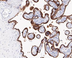 Invitrogen SMS Recombinant Rabbit Monoclonal Antibody (JE61-85) 100 &mu;L;
