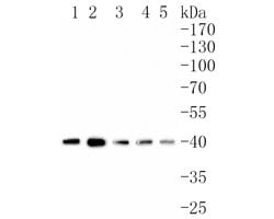 Invitrogen SMS Recombinant Rabbit Monoclonal Antibody (JE61-85) 100 &mu;L;