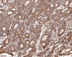 Invitrogen CHM Recombinant Rabbit Monoclonal Antibody (JE61-83) 100 &mu;L;