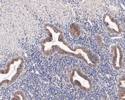 Invitrogen CHM Recombinant Rabbit Monoclonal Antibody (JE61-83) 100 &mu;L;