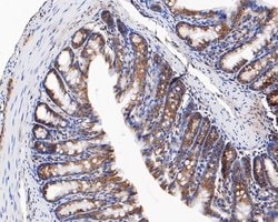 Invitrogen CHM Recombinant Rabbit Monoclonal Antibody (JE61-83) 100 &mu;L;