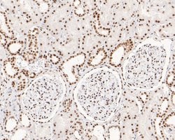 Invitrogen NOLA3 Recombinant Rabbit Monoclonal Antibody (JE61-51) 100 &mu;L;