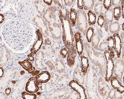 Invitrogen SAMM50 Recombinant Rabbit Monoclonal Antibody (JE61-49) 100