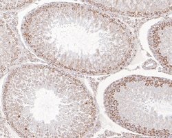 Invitrogen SAMM50 Recombinant Rabbit Monoclonal Antibody (JE61-49) 100