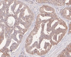 Invitrogen DPP3 Recombinant Rabbit Monoclonal Antibody (JE61-30) 100 &mu;L;