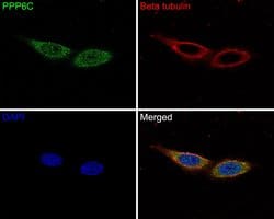 Invitrogen PPP6C Recombinant Rabbit Monoclonal Antibody (JE61-21) 100 &mu;L;