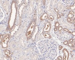 Invitrogen PPP6C Recombinant Rabbit Monoclonal Antibody (JE61-21) 100 &mu;L;