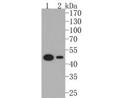 Invitrogen ELP4 Recombinant Rabbit Monoclonal Antibody (JE61-03) 100 &mu;L;