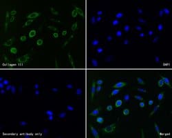 Invitrogen Collagen III Recombinant Rabbit Monoclonal Antibody (JE60-79)