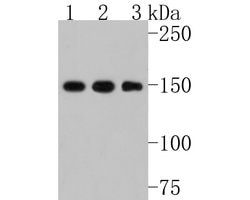 Invitrogen Collagen III Recombinant Rabbit Monoclonal Antibody (JE60-79)