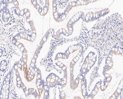 Invitrogen GBP1 Recombinant Rabbit Monoclonal Antibody (JE60-78) 100 &mu;L;