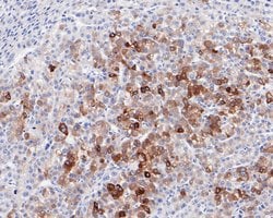 Invitrogen FDFT1 Recombinant Rabbit Monoclonal Antibody (JE60-69) 100 &mu;L;