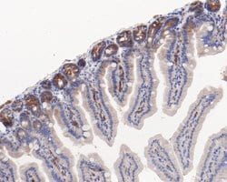 Invitrogen ELP3 Recombinant Rabbit Monoclonal Antibody (JE60-10) 100 &mu;L;