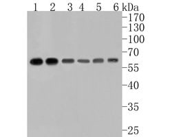 Invitrogen ELP3 Recombinant Rabbit Monoclonal Antibody (JE60-10) 100 &mu;L;