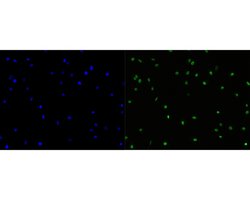 Invitrogen CDCA5 Recombinant Rabbit Monoclonal Antibody (JE59-54) 100 &mu;L;
