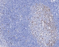Invitrogen CDCA5 Recombinant Rabbit Monoclonal Antibody (JE59-54) 100 &mu;L;