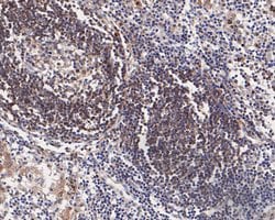 Invitrogen CD79b Recombinant Rabbit Monoclonal Antibody (JE58-34) 100 &mu;L;