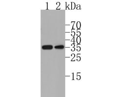 Invitrogen CD79b Recombinant Rabbit Monoclonal Antibody (JE58-34) 100 &mu;L;