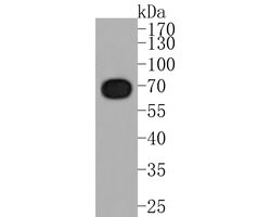 TUB Recombinant Rabbit Monoclonal Antibody (JE58-75):Antibodies, Recombinant