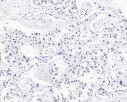 Invitrogen USP39 Recombinant Rabbit Monoclonal Antibody (JE59-07) 100 &mu;L | Buy Online | Invitrogen&trade; | Fisher Scientific