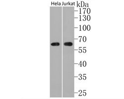 Invitrogen USP39 Recombinant Rabbit Monoclonal Antibody (JE59-07) 100 &mu;L | Buy Online | Invitrogen&trade; | Fisher Scientific