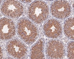 Invitrogen Tug Recombinant Rabbit Monoclonal Antibody (JE59-09) 100 &mu;L;