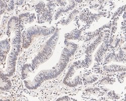 Invitrogen SRP19 Recombinant Rabbit Monoclonal Antibody (JE59-23) 100 &mu;L;