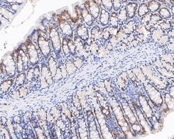 Invitrogen SRP19 Recombinant Rabbit Monoclonal Antibody (JE59-23) 100 &mu;L;