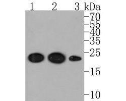 Invitrogen SRP19 Recombinant Rabbit Monoclonal Antibody (JE59-23) 100 &mu;L;