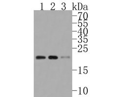 Invitrogen SRP19 Recombinant Rabbit Monoclonal Antibody (JE59-23) 100 &mu;L;
