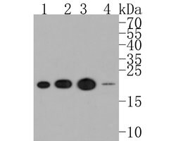 Invitrogen RCL Recombinant Rabbit Monoclonal Antibody (JE59-29) 100 &mu;L;