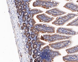 Invitrogen ZPR1 Recombinant Rabbit Monoclonal Antibody (JE58-88) 100 &mu;L | Buy Online | Invitrogen&trade; | Fisher Scientific